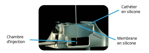 catheters chambre implantable